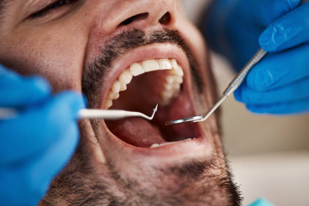 Best Full Mouth Reconstruction  in Brenham, TX